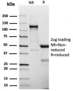 SDS-PAGE analysis of purified, BSA-free CD25 antibody (clone IL2RA/4375R) as confirmation of integrity and purity.