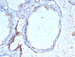 IHC staining of FFPE human thyroid tissue with GAD2 (GAD65) antibody (clone GAD2/6484). HIER: boil tissue sections in pH 9 10mM Tris with 1mM EDTA for 20 min and allow to cool before testing.