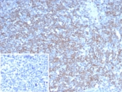 IHC staining of FFPE human tonsil tissue with NEUROG3 antibody (clone NGN3/1808) Inset: PBS used in place of primary Ab (secondary Ab negative control). HIER: boil tissue sections in pH 9 10mM Tris with 1mM EDTA for 20 min and allow to cool before testing.