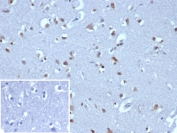 IHC staining of FFPE human brain tissue with NEUROG3 antibody (clone NGN3/1808) HIER: boil tissue sections in pH 9 10mM Tris with 1mM EDTA for 20 min and allow to cool before testing.