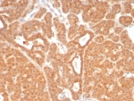 IHC staining of FFPE human parathyroid tissue with c-RET antibody (clone RET/8789). HIER: boil tissue sections in pH 9 10mM Tris with 1mM EDTA for 20 min and allow to cool before testing.