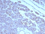 IHC staining of FFPE human parathyroid tissue with c-RET antibody (clone RET/8791). HIER: boil tissue sections in pH 9 10mM Tris with 1mM EDTA for 20 min and allow to cool before testing.