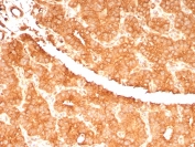 IHC staining of FFPE human parathyroid gland tissue with c-RET Proto-oncogene antibody (clone RET/7694). HIER: boil tissue sections in pH 9 10mM Tris with 1mM EDTA for 20 min and allow to cool before testing.