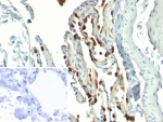 IHC staining of FFPE human lung tissue with Surfactant Protein D antibody (clone SFTPD/4362). Inset: PBS used in place of primary Ab (secondary Ab negative control). HIER: boil tissue sections in pH 9 10mM Tris with 1mM EDTA for 20 min and allow to cool before testing.