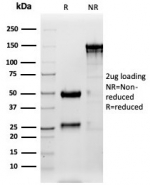 SDS-PAGE analysis of purified, BSA-free Surfactant Protein D antibody (clone SFTPD/4362) as confirmation of integrity and purity.