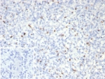 IHC staining of FFPE human spleen tissue with Perforin-1 antibody (clone rPRF1/8058). Inset: PBS used in place of primary Ab (secondary Ab negative control). HIER: boil tissue sections in pH 9 10mM Tris with 1mM EDTA for 20 min and allow to cool before testing.