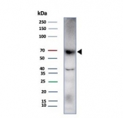 Western blot testing of human HDLM-2 cell lysate with Perforin-1 antibody (clone rPRF1/8058). Predicted molecular weight ~61 kDa.