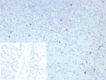 IHC staining of FFPE human spleen tissue with Perforin-1 antibody (clone PRF1/8662R). Inset: PBS used in place of primary Ab (secondary Ab negative control). HIER: boil tissue sections in pH 9 10mM Tris with 1mM EDTA for 20 min and allow to cool before testing.