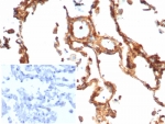 IHC staining of FFPE human lung tissue with Vinculin antibody (clone rVCL/7287). Inset: PBS used in place of primary Ab (secondary Ab negative control). HIER: boil tissue sections in pH 9 10mM Tris with 1mM EDTA for 20 min and allow to cool before testing.