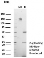 SDS-PAGE analysis of purified, BSA-free Vinculin antibody (clone VCL/8533R) as confirmation of integrity and purity.