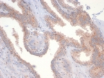 IHC staining of FFPE human prostate tissue with PTEN antibody (clone PTEN/7345) at 2ug/ml. HIER: boil tissue sections in pH 9 10mM Tris with 1mM EDTA for 20 min and allow to cool before testing.