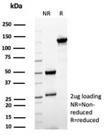 SDS-PAGE analysis of purified, BSA-free SFTPD antibody (clone rSFTPD/8065) as confirmation of integrity and purity.