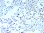 IHC staining of FFPE human lung tissue with Surfactant Protein D antibody (clone rSFTPD/8065). Inset: PBS used in place of primary Ab (secondary Ab negative control). HIER: boil tissue sections in pH 9 10mM Tris with 1mM EDTA for 20 min and allow to cool before testing.