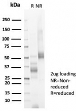 SDS-PAGE analysis of purified, BSA-free Ki67 antibody (clone MKI67/6582) as confirmation of integrity and purity.