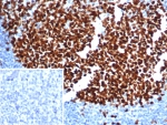 IHC staining of FFPE human tonsil tissue with Ki67 antibody (clone MKI67/6582). Inset: PBS used in place of primary Ab (secondary Ab negative control). HIER: boil tissue sections in pH 9 10mM Tris with 1mM EDTA for 20 min and allow to cool before testing.