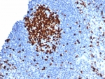 IHC staining of FFPE human tonsil tissue with Ki67 antibody (clone MKI67/6582). HIER: boil tissue sections in pH 9 10mM Tris with 1mM EDTA for 20 min and allow to cool before testing.