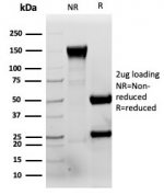 SDS-PAGE analysis of purified, BSA-free RBP4 antibody (clone RBP4/4046) as confirmation of integrity and purity.