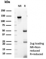 SDS-PAGE analysis of purified, BSA-free RBP4 antibody (clone RBP4/8090R) as confirmation of integrity and purity.