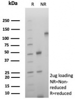 SDS-PAGE analysis of purified, BSA-free CD39 antibody (clone rCD39/8682) as confirmation of integrity and purity.