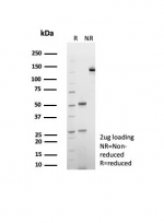 SDS-PAGE analysis of purified, BSA-free CD39 antibody (clone CD39/8538R) as confirmation of integrity and purity.