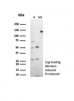 SDS-PAGE analysis of purified, BSA-free CD39 antibody (clone CD39/8538R) as confirmation of integrity and purity.