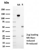 SDS-PAGE analysis of purified, BSA-free KCNIP2 antibody (clone KCNIP2/7588) as confirmation of integrity and purity.
