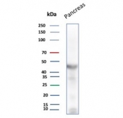 Western blot testing of human pancreas tissue lysate with Pancreatic lipase antibody (clone PNLIP/8916). Predicted molecular weight ~51 kDa.