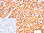 IHC staining of FFPE human pancreas tissue with Pancreatic lipase antibody (clone PNLIP/8916). Inset: PBS used in place of primary Ab (secondary Ab negative control). HIER: boil tissue sections in pH 9 10mM Tris with 1mM EDTA for 20 min and allow to cool before testing.