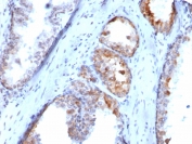 IHC staining of FFPE human prostate tissue with SLC18A2 antibody (clone SLC18A2/7983). HIER: boil tissue sections in pH 9 10mM Tris with 1mM EDTA for 20 min and allow to cool before testing.