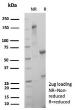 SDS-PAGE analysis of purified, BSA-free MGMT antibody (clone MGMT/8319R) as confirmation of integrity and purity.