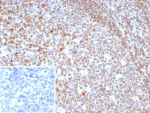 IHC staining of FFPE human tonsil tissue with MGMT antibody (clone MGMT/8319R). Inset: PBS used in place of primary Ab (secondary Ab negative control). HIER: boil tissue sections in pH 9 10mM Tris with 1mM EDTA for 20 min and allow to cool before testing.