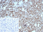 IHC staining of FFPE human tonsil tissue with Ki67 antibody (clone rMKI67/8852). Inset: PBS used in place of primary Ab (secondary Ab negative control). HIER: boil tissue sections in pH 9 10mM Tris with 1mM EDTA for 20 min and allow to cool before testing.