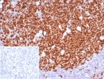 IHC staining of FFPE human tonsil tissue with Ki67 antibody (clone MKI67/8315R). Inset: PBS used in place of primary Ab (secondary Ab negative control). HIER: boil tissue sections in pH 9 10mM Tris with 1mM EDTA for 20 min and allow to cool before testing.