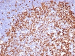 IHC staining of FFPE human tonsil. Ki67 antibody (clone MKI67/8315R). HIER: boil tissue sections in pH 9 10mM Tris with 1mM EDTA for 20 min and allow to cool before testing.