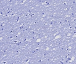 Negative control: IHC testing of FFPE human brain tissue with MGMT antibody (clone MGMT/8364R) at 2ug/ml. HIER: boil tissue sections in pH 9 10mM Tris with 1mM EDTA for 20 min and allow to cool before testing.