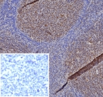 IHC staining of FFPE human tonsil tissue with MGMT antibody (clone MGMT/8364R). Inset: PBS used in place of primary Ab (secondary Ab negative control). HIER: boil tissue sections in pH 9 10mM Tris with 1mM EDTA for 20 min and allow to cool before testing.
