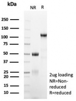 SDS-PAGE analysis of purified, BSA-free MGMT antibody (clone MGMT/8364R) as confirmation of integrity and purity.