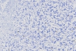 Negative control: IHC testing of FFPE human brain tissue with MGMT antibody (clone MGMt/8128R) at 2ug/ml. HIER: boil tissue sections in pH 9 10mM Tris with 1mM EDTA for 20 min and allow to cool before testing.