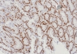 IHC staining of FFPE human stomach (corpus) tissue with MGMT antibody (clone MGMT/8128R). HIER: boil tissue sections in pH 9 10mM Tris with 1mM EDTA for 20 min and allow to cool before testing.