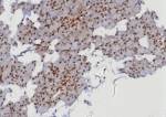 IHC staining of FFPE human parotid gland with MGMT antibody (clone MGMT/8128R). HIER: boil tissue sections in pH 9 10mM Tris with 1mM EDTA for 20 min and allow to cool before testing.