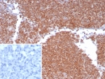 IHC staining of FFPE human lymph node tissue with MGMT antibody (clone MGMT/8186R). Inset: PBS used in place of primary Ab (secondary Ab negative control). HIER: boil tissue sections in pH 9 10mM Tris with 1mM EDTA for 20 min and allow to cool before testing.
