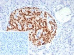 IHC staining of FFPE human pancreas tissue with PAX6 antibody (clone PAX6/7708). Inset: PBS used in place of primary Ab (secondary Ab negative control). HIER: boil tissue sections in pH 9 10mM Tris with 1mM EDTA for 20 min and allow to cool before testing.