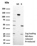 SDS-PAGE analysis of purified, BSA-free PAX6 antibody (clone PAX6/7707) as confirmation of integrity and purity.