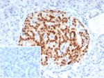 IHC staining of FFPE human pancreas tissue with PAX6 antibody (clone PAX6/7707). Inset: PBS used in place of primary Ab (secondary Ab negative control). HIER: boil tissue sections in pH 9 10mM Tris with 1mM EDTA for 20 min and allow to cool before testing.