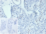 IHC staining of FFPE human testis tissue with Wilms Tumor antibody (clone WT1/7450). Inset: PBS used in place of primary Ab (secondary Ab negative control). HIER: boil tissue sections in pH 9 10mM Tris with 1mM EDTA for 20 min and allow to cool before testing.