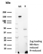 SDS-PAGE analysis of purified, BSA-free Wilms Tumor 1 antibody (clone WT1/7451) as confirmation of integrity and purity.