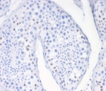 IHC staining of FFPE human testis tissue with Wilms Tumor 1 antibody (clone WT1/7451). HIER: boil tissue sections in pH 9 10mM Tris with 1mM EDTA for 20 min and allow to cool before testing.