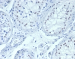 IHC staining of FFPE human testis tissue with Wilm's Tumor antibody (clone WT1/7452). HIER: boil tissue sections in pH 9 10mM Tris with 1mM EDTA for 20 min and allow to cool before testing.