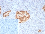 IHC staining of FFPE human pancreas tissue with PAX6 antibody (clone PAX6/7729). Inset: PBS used in place of primary Ab (secondary Ab negative control). HIER: boil tissue sections in pH 9 10mM Tris with 1mM EDTA for 20 min and allow to cool before testing.