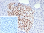 IHC staining of FFPE human pancreas tissue with PAX6 antibody (clone PAX6/7705). Inset: PBS used in place of primary Ab (secondary Ab negative control). HIER: boil tissue sections in pH 9 10mM Tris with 1mM EDTA for 20 min and allow to cool before testing.